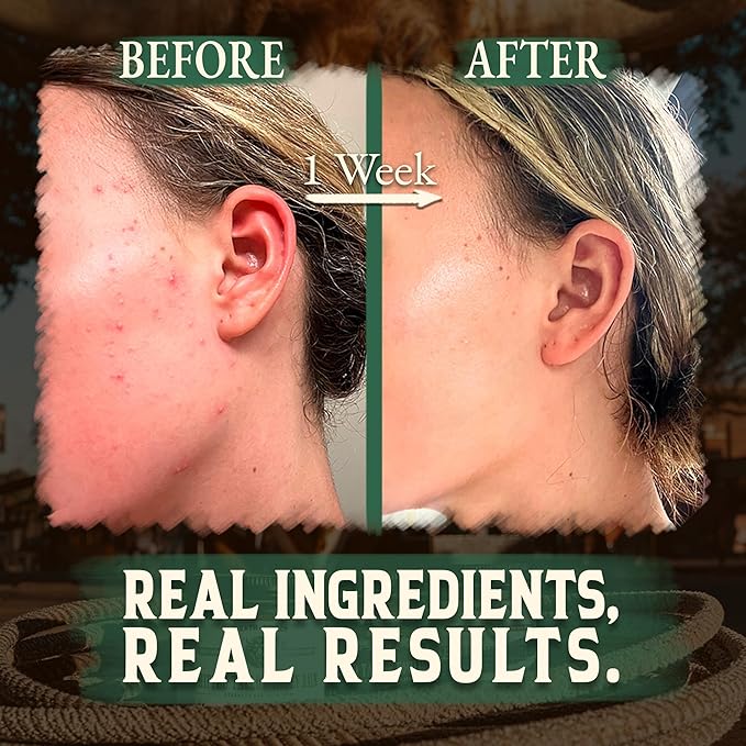 Organic Beef Tallow for Skin - 4 OZ (Eucalyptus) — Grass Fed Beef Tallow for face + Body — US-Made Whipped Tallow and Honey Balm Moisturizer for Dry and Sensitive Skin, Eczema, Rosacea (No Additives)