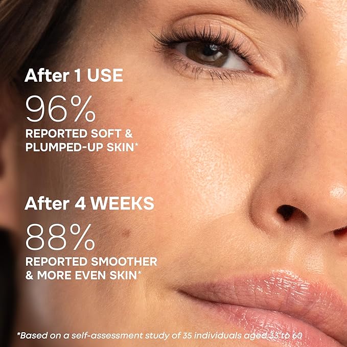 SimplyVital Collagen, Retinol & Hyaluronic Acid Serum - Anti-Aging Moisturizer for Face, Neck & Décolleté - Made in USA, Deep Moisturizing Skin Care Complex - Hydrating Facial Serum for Women, 1 fl.oz