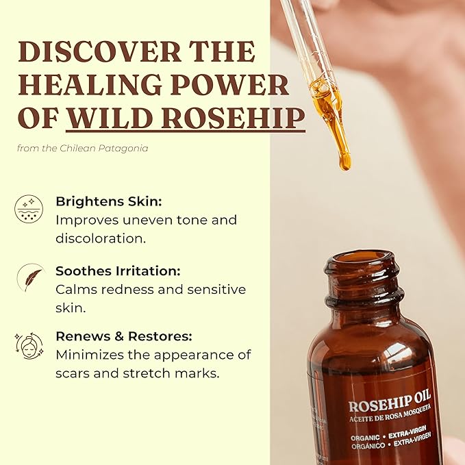 Offernova Organic Rosa de Mosqueta Oil- USDA Certified Rosehip Seed Oil Pure Cold Pressed, Repairs & Brightens Skin - Gua Sha Massage, Face, for All Skin Types - Aceite Facial 1OZ