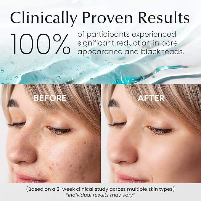 Korean Toner Pads With Witch Hazel - 100 Ct | Hydrating, Exfoliating Pads & Pore Care Korean Skincare - Gentle, Alcohol-Free, with Glycerin and Centella for Sensitive Skin by La Pure Cosmetics