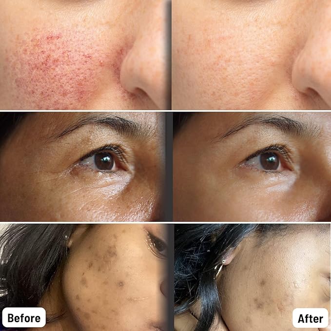 ORGAID Organic Sheet Mask | Made in USA (Vitamin C & Revitalizing, pack of 4)