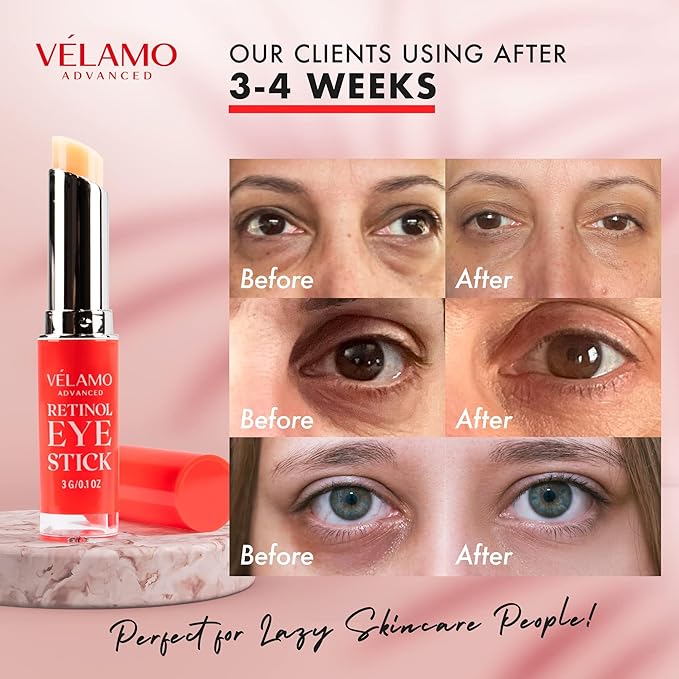 VELAMO ADVANCED Retinol Eye Balm Stick with Bakuchiol: Under Eye Cream for Dark Circles and Puffiness - Anti Aging Reduces Fine Lines Wrinkles Under Eye Bags in 4-8 Weeks 0.1 OZ/3g