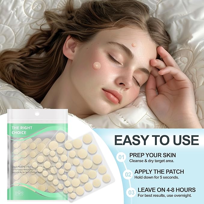 Pimple Patches for Face 5pack,Hydrocolloid Acne Pimple Patches for Covering Zits and Blemishes