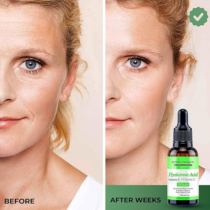 Hyaluronic Acid Serum (5oz) – 100% Pure Hyaluronic Serum for face & Anti-Aging Formula for Face – Wrinkle Reduction, Brightening & Moisturizing with Vitamin C for All Skin Types