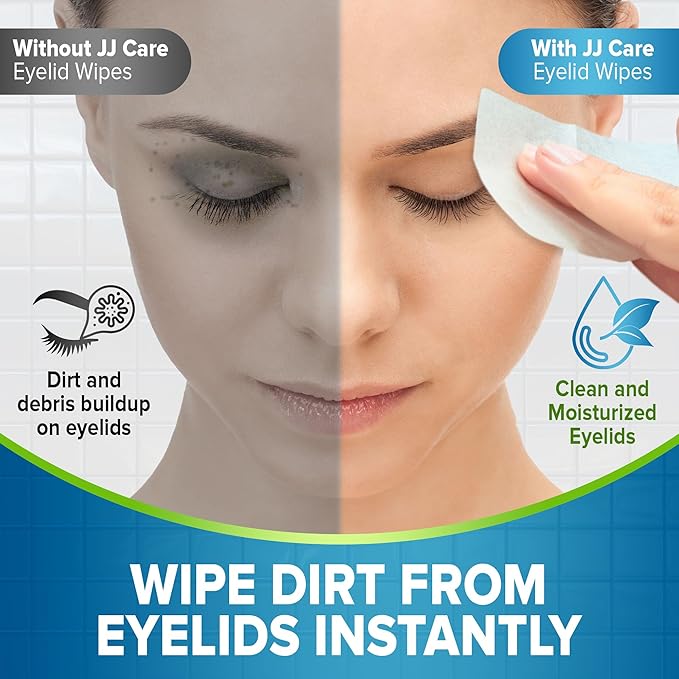 JJ CARE Eyelid Cleaning Wipes - Box of 80, 4"x4" Individually Wrapped Moisturizing Eye Lid Scrubbing Wipes for Irritated, Itchy, and Dry Eyes, Hypoallergenic Eye Scrub & Eyelashes cleaning Pads