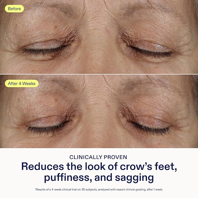 Skinfix Triple Lipid Eye Treatment - 0.5 fl oz - Eye Cream - Visibly Tightens, Depuffs & Smooths Undereyes - Non-Comedogenic - Fragrance Free - Vegan, Cruelty Free