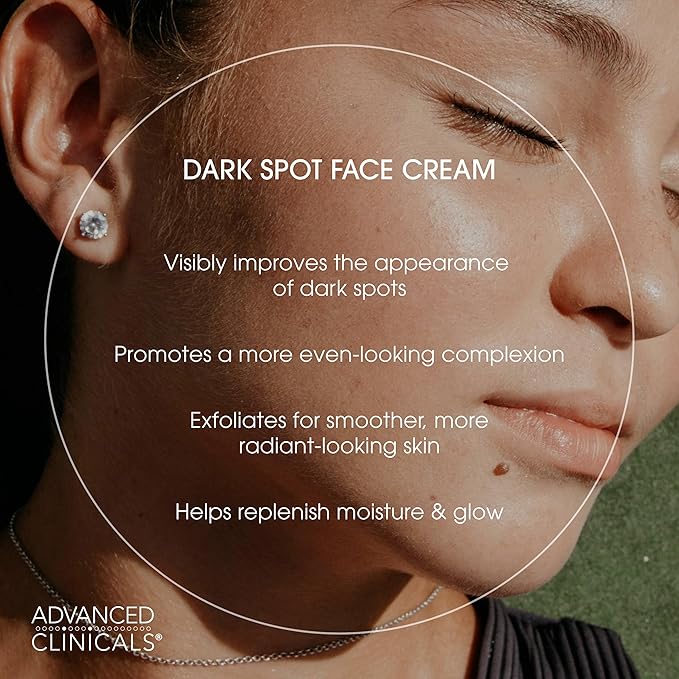Advanced Clinicals Dark Spot Face Moisturizer | Lactic Acid Lotion For Face With Caffeine, Cocoa Butter, & Vitamin A | Brightening Cream Visibly Reduces Look Of Dark Spots & Uneven Skin Tone, 2 Fl Oz