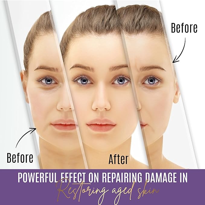 Wrinkle Cream for Face Deep Wrinkles – Anti Wrinkle Cream for Women with Peptides, Hyaluronic Acid & Aloe Vera – Skin Firming Moisturizer to Tighten, Lift & Boost Elasticity – 1.7 Fl Oz