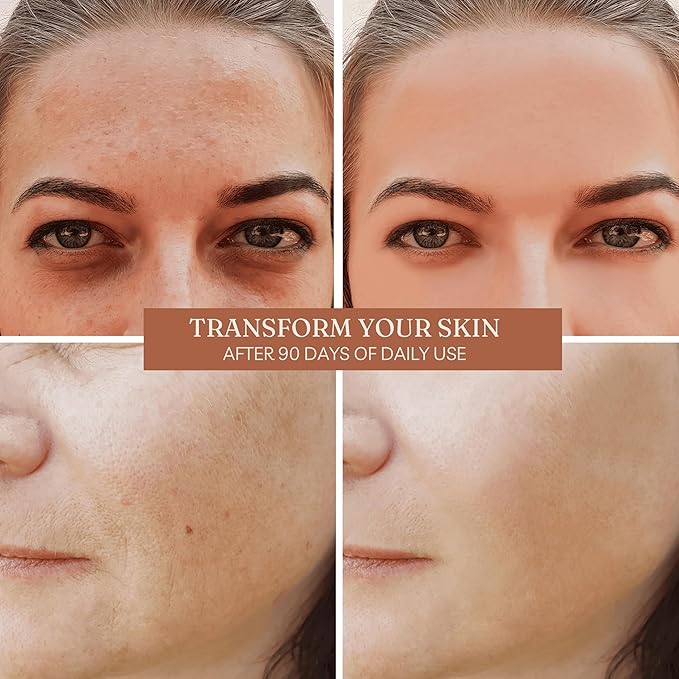 Offernova Organic Rosa de Mosqueta Oil- USDA Certified Rosehip Seed Oil Pure Cold Pressed, Repairs & Brightens Skin - Gua Sha Massage, Face, for All Skin Types - Aceite Facial 1OZ