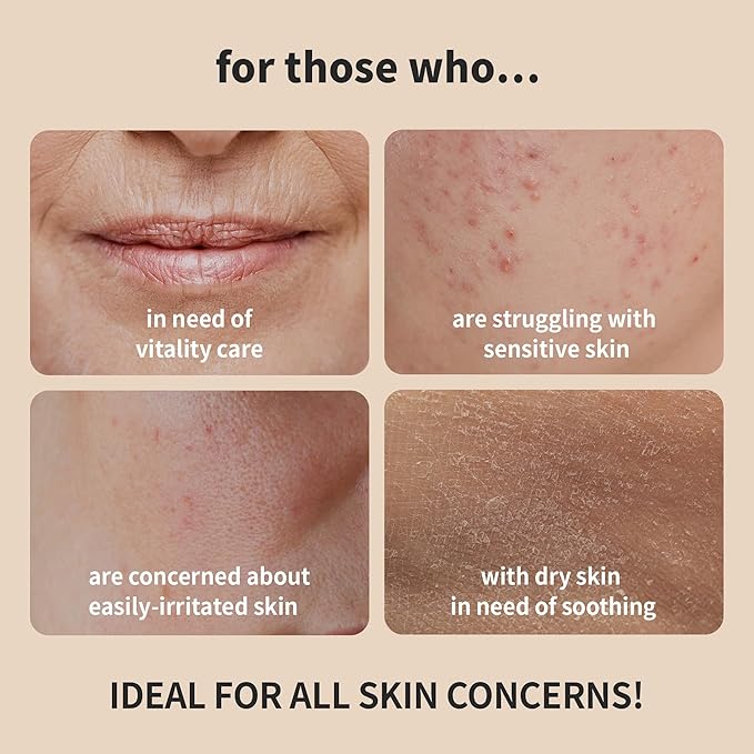 BENTON Snail Bee High Content Skin (Toner) - Snail Mucin Toner, Snail Mucin Essence Toner, Bee Venom Korean Toner, Korean Skin Care Snail Toner, Face Skin Care Snail Essence, Snail Mucin Moisturizer