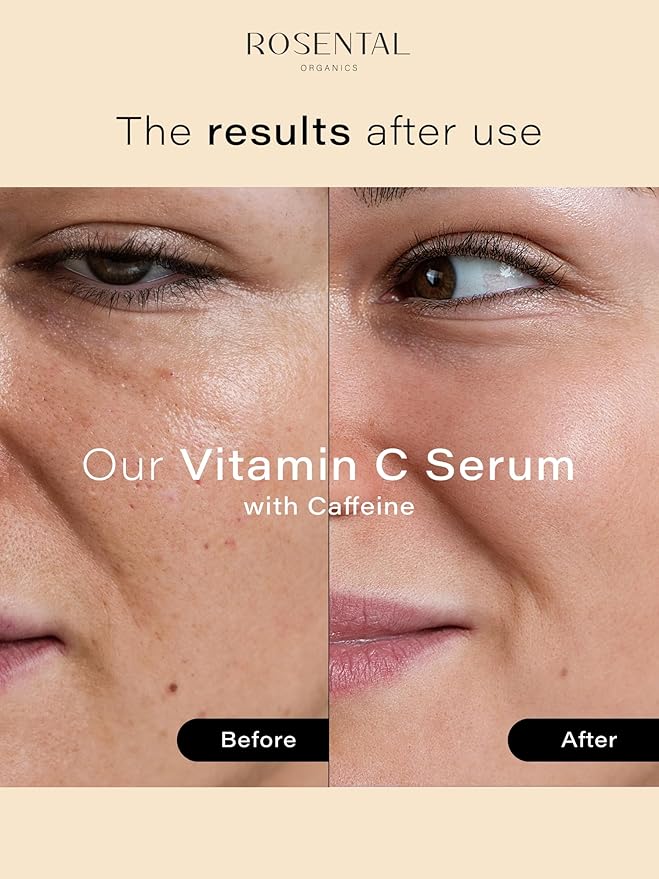 Organics Vitamin C Serum with Caffeine (30ml) – Hydrating Face Serum for Dark Spots, Acne Scars, Wrinkles – Brightening & Anti-Aging Facial Care – Natural Cosmetics – Made in Germany