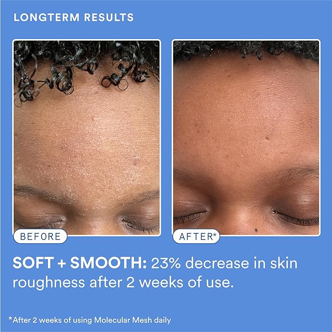 Experiment Molecular Mesh Barrier Repair Moisturizer – Soothing Lightweight Face Cream for Strength, Redness & Irritation - Ectoin, Phytosphingosine, Centella 2 FL OZ - Vegan for Sensitive Skin