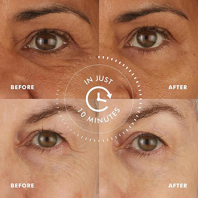 Skyn ICELAND Hydro Cool Firming Under Eye Patches, Instant Cooling for Puffy, Tired Eyes with Peptides and Coenzyme Q10, 10 Minute Treatment, Vegan, All Skin Types, 16 Pairs