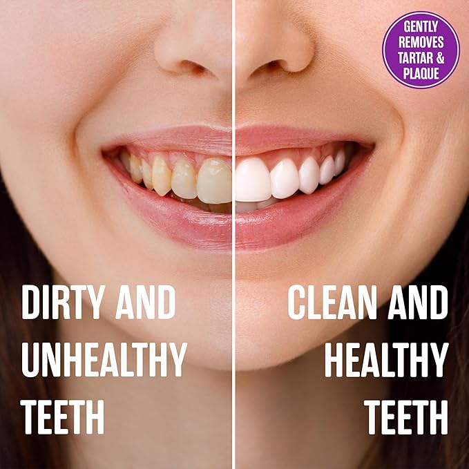 SprinJene Natural Fluoride Free Toothpaste for Sensitive Teeth & Gums – Patented Toothpaste with Black Seed Oil & Zinc – Vegan Dry Mouth Prevention for Fresh Breath – Made in The USA (2 Pack)