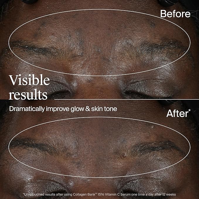 Neutrogena Collagen Bank 15% Vitamin C Face Serum, Vitamin C Serum for Face Helps Build Collagen for Glowing, Plumper Looking Skin, Uneven Skin Tone Treatment, Fragrance Free, 0.5 fl. oz