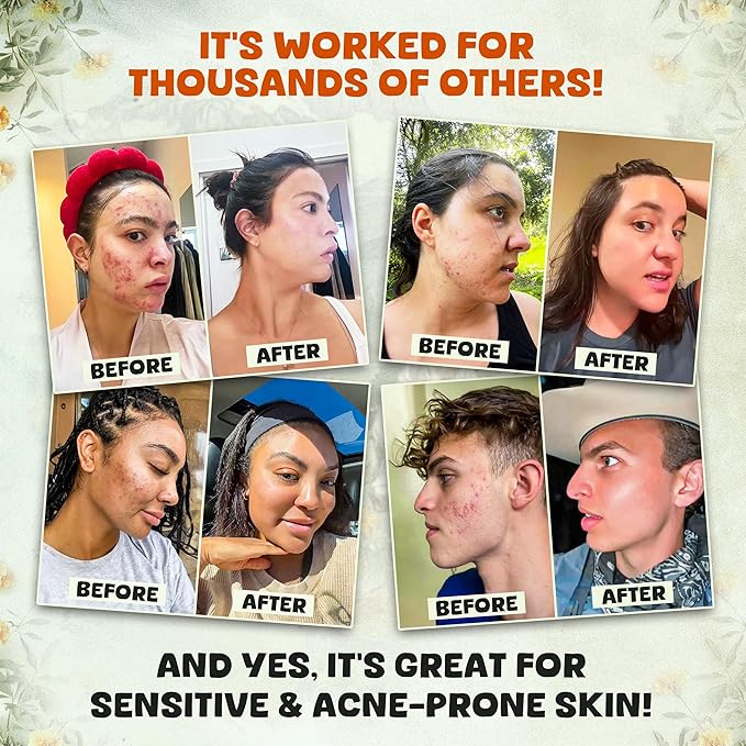 Whipped Beef Tallow and Honey Balm Moisturizer for Skin, Face, Lips, Body - Lavender