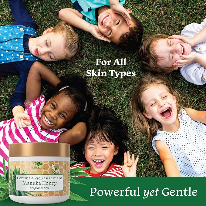 Green Leaf Naturals Manuka Honey Eczema Cream Moisturizing Lotion Fragrance Free for Psoriasis Relief - Itchy, Dry Skin Ointment - Skin Soothing Moisturizer - Body & Face Cream - Kids & Adults 4oz