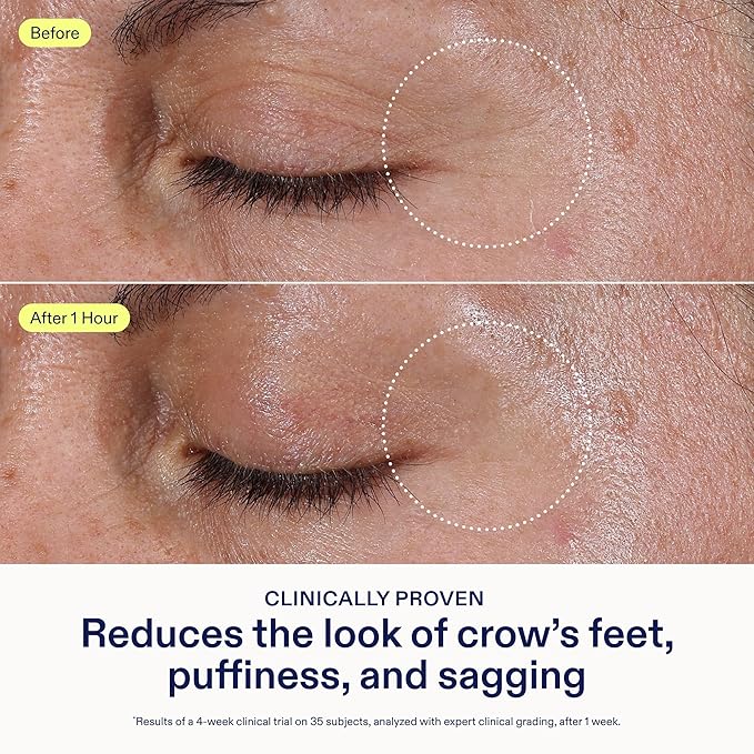 Skinfix Triple Lipid Eye Treatment - 0.5 fl oz - Eye Cream - Visibly Tightens, Depuffs & Smooths Undereyes - Non-Comedogenic - Fragrance Free - Vegan, Cruelty Free